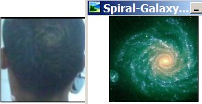 Top-of-head-spiral-galaxy.jpg